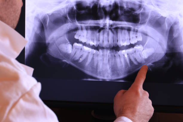 Best Dental Abscess Treatment in Rockland, ME